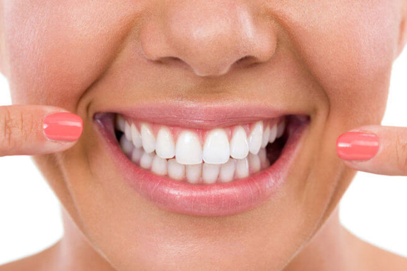 Teeth Whitening Business Name Idea