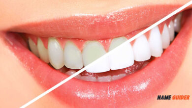 Teeth Whitening Business Name Ideas